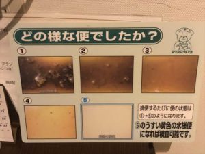 大腸内視鏡検査 202004
